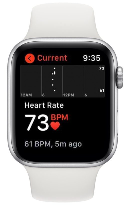 Surveillance de la fréquence cardiaque de l'Apple Watch