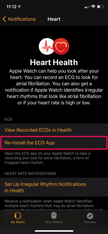 Comment enregistrer un ECG sur Apple Watch